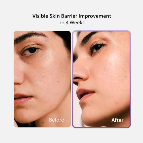 BLITHE: Vital Treatment 8 Nourishing Beans 54ml