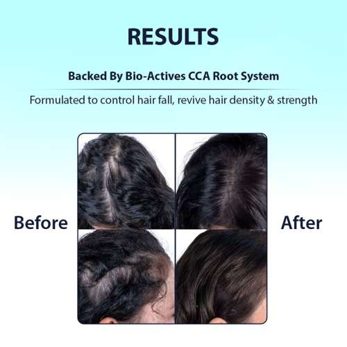 Dermistry: Anti Hair Fall Control Hair Mask Caffeine Collagen Arginine for Root Strengthening 200ml
