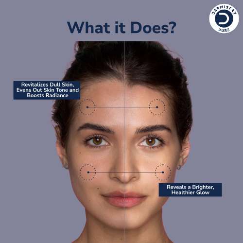 Dermistry: 30% AHA 5% PHA 2% BHA Peeling Solution Face Serum Glowing Skin Exfoliating Chemical Peel 30ml