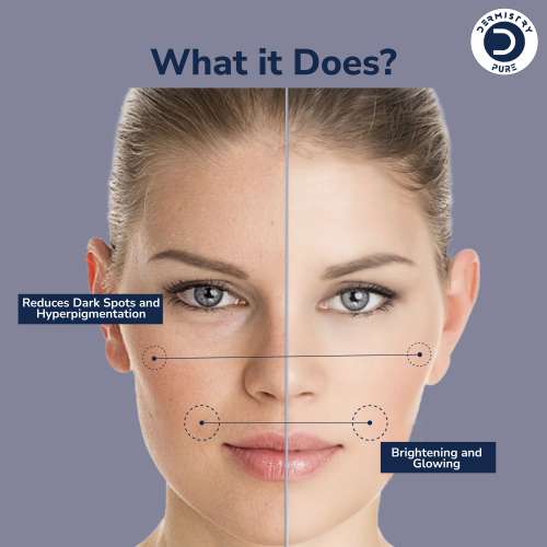 Dermistry: 16% Vitamin C 1% Alpha Arbutin Pigmentation Dark Spot Removal Glowing Skin Whitening Serum 30ml