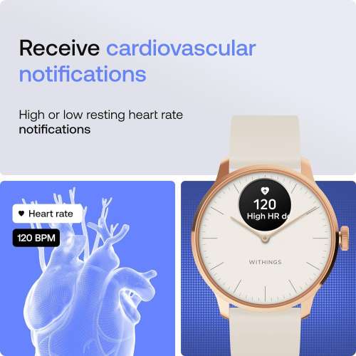 Withings: ScanWatch Light - Hybrid Smartwatch, Rose Gold