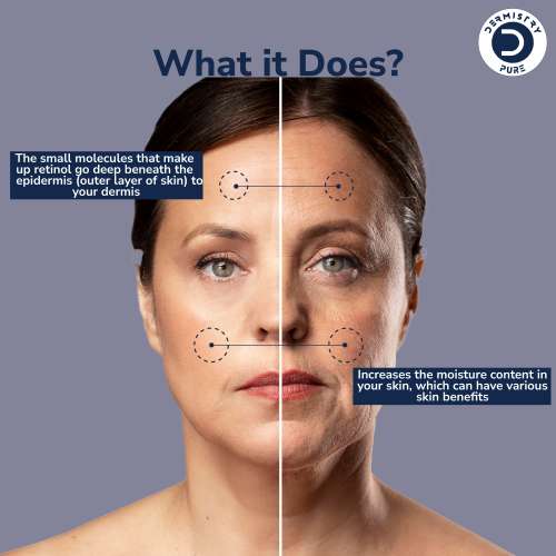 Dermistry: 1% Retinol Hyaluronic Acid Anti Aging Day Night Face Serum For Ageing Dark Circle Wrinkles 30ml