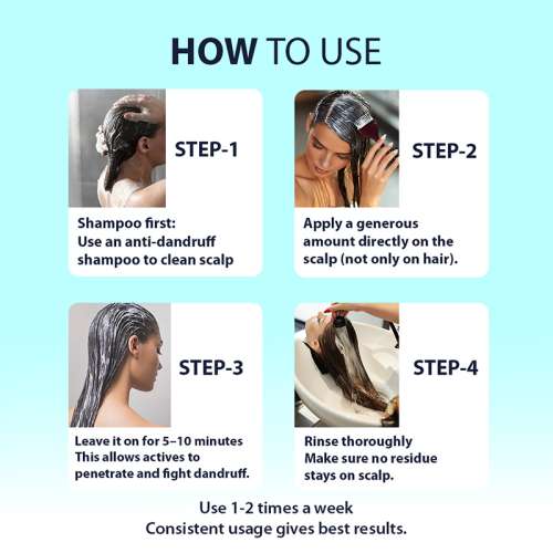 Dermistry: Anti Dandruff Hair Mask Piroctone Climbazole & ZPTO Treatment for Flakes Dry Itchy Scalp 200ml