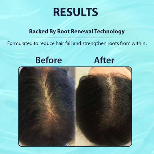 Dermistry: Anti Hair Fall Control Hair Serum with Follicusan Hairgenyl Caffeine for Strength & Growth 50ml