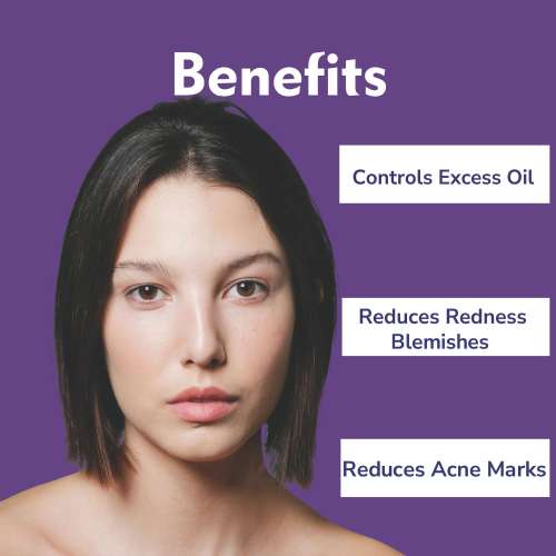 Dermistry: 2% Salicylic Acid 5% Niacinamide Face Serum For Oily Acne Prone Skin Open Pores Spot Scars 30ml