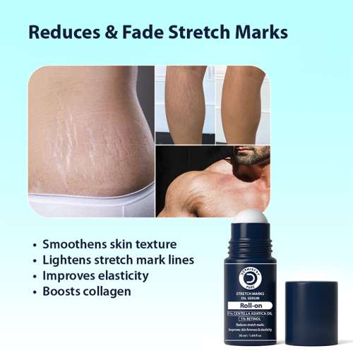 Dermistry: Stretch Marks Scar Removal Roll On Oil Serum Pregnancy Safe with Shea Butter Bio Oils 50ml