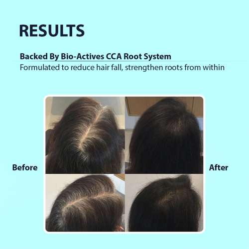 Dermistry: Anti Hair Fall Shampoo Caffeine Collagen for Root Strengthening Breakage Thinning Control 200ml