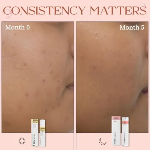 SkinInspired: Desqua Mate AHA+BHA+PHA Serum | Exfoliating Serum | Pore Refining & Skin Renewal | 30ml