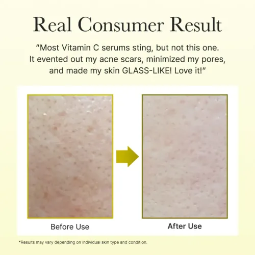 Arencia: Vitamin C Booster Shot Serum with 5% Dual Vitamin C + Glutathione For Dark Spot Care | Dark Spot Care | Brightening | 30ml