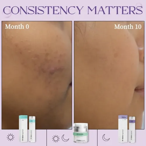 SkinInspired: Retinol Face Serum | Anti-Ageing | Fine Lines & Wrinkle Repair | 30ml