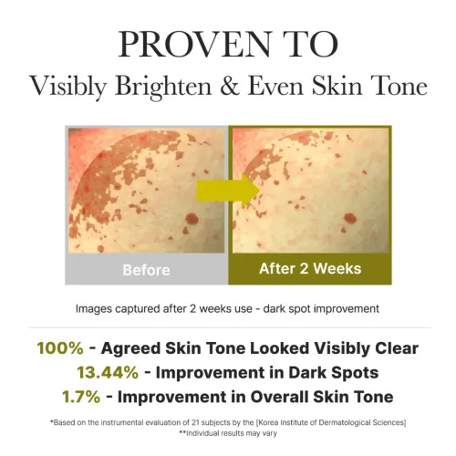 Arencia: Vitamin C Booster Shot Serum with 5% Dual Vitamin C + Glutathione For Dark Spot Care | Dark Spot Care | Brightening | 30ml