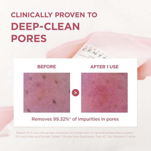 SKIN1004: Madagascar Centella Poremizing Deep Cleansing Foam  | Calming Care | Sensitive Skin | Face Cleanser | Deep Cleansing | Pore Care | 125ml