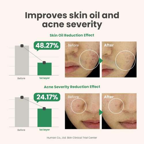 AXIS-Y: Spot the Difference Blemish Treatment | Acne Spot Care | Blemish Reduction | Targeted Treatment | Pore Clearing | 15ml