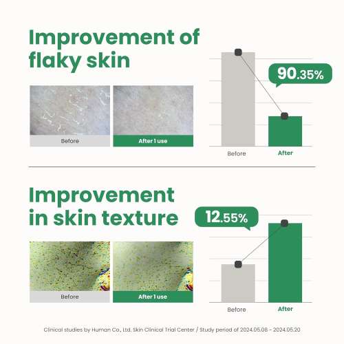 AXIS-Y: PHA Resurfacing Glow Peel | PHA Exfoliation | Skin Resurfacing | Brightening | Glow Boost | 50ml