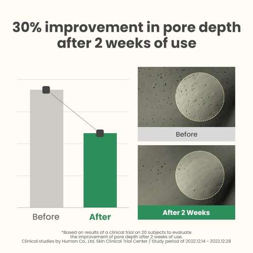 AXIS-Y: LHA Peel & Fill Pore Balancing Cream | Blackhead Remover | Pore Minimizing | Skin Balancing | Texture Refinement | 50ml
