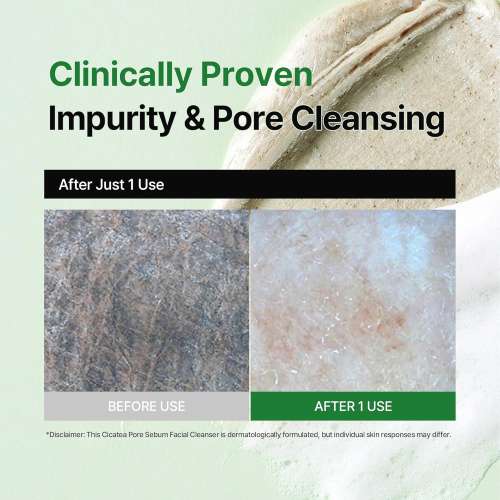 Dewdap: Cicatea Pore & Sebum Pack Cleanser | Pore Minimizing Cleanser | Sebum Control | 150ml
