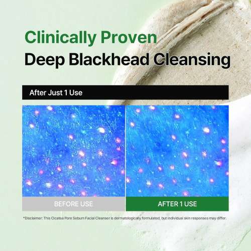 Dewdap: Cicatea Pore & Sebum Pack Cleanser | Pore Minimizing Cleanser | Sebum Control | 150ml