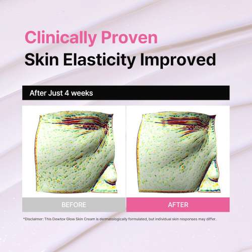 Dewdap: Dewtox EX Active V-Fit Cream | Exosome Skin Repair | Firming | Anti-Wrinkle | Skin Tightening | Deep Hydration | 50ml