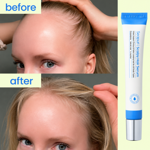 Seapuri: Scalpy Hair Serum | Radiance | Removes Scalp Buildup | Soothes Irritation | Strengthens Roots | 20ml
