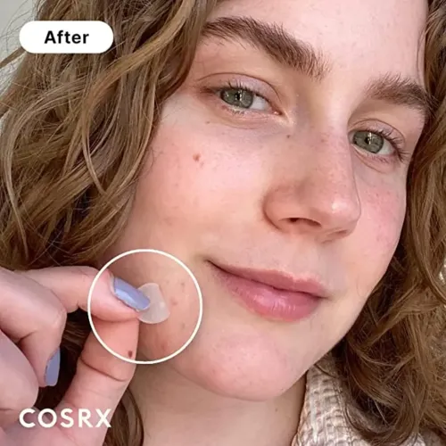 COSRX: Master Patch Original Fit | Acne Pimple Patch | Hydrocolloid Patch | Blemish Care | Spot Treatment | 24 Patches