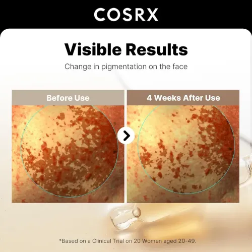 COSRX: The Alpha-Arbutin 2 Discoloration Care Serum | Dark Spot Corrector | Pigmentation Care | Even Skin Tone | 50ml