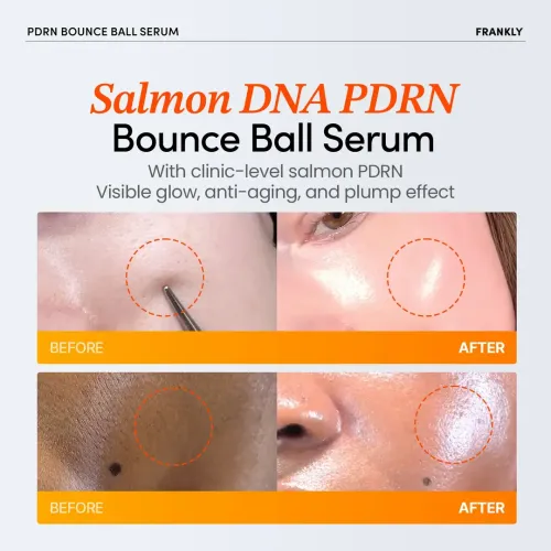 Frankly: PDRN Bounce Ball Serum | Salmon DNA | 99% Pure PDRN | Skin Repair | Post-Microneedling | Anti-Aging | Glass Skin | Korean Skincare | 30ml