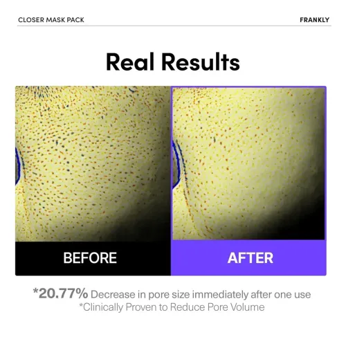 Frankly: Closer Mask | 9 Peptides | Rice Extract | Pore Tightening | Hydration | Anti-Aging | Sheet Mask | Korean Skincare | 10ea