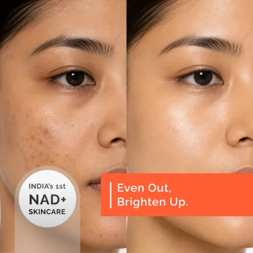 Beyond Beyond: Advanced Complexion Corrector Serum  30gm