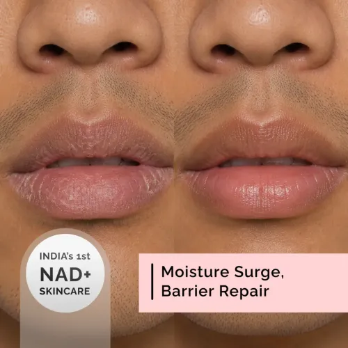 Beyond Beyond: Moisture Surge Lip Butter  10gm