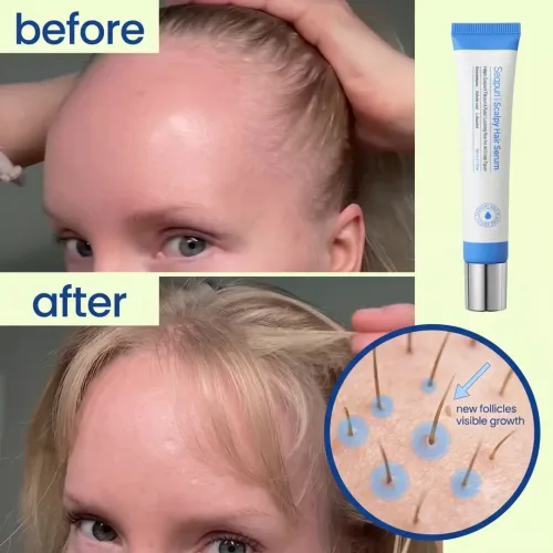 Seapuri: Scalpy Hair Serum | Radiance | Removes Scalp Buildup | Soothes Irritation | Strengthens Roots | 20ml
