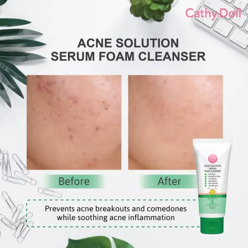 Cathy Doll: Acne Solution Serum Foam Cleanser | Anti-Acne Face Wash | Oil Control & Pore Care | 100ml