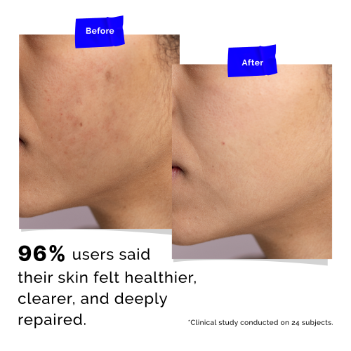 Beyond Beyond: The Ultimate Night Repair SuperCream  50gm