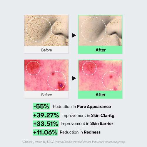VT Cosmetics: CICA Reedle Shot 100 Essence | For Hydration & Smooth Skin | Skin Renewal | Pore Smoothing | Sensitive Skin | 50ml