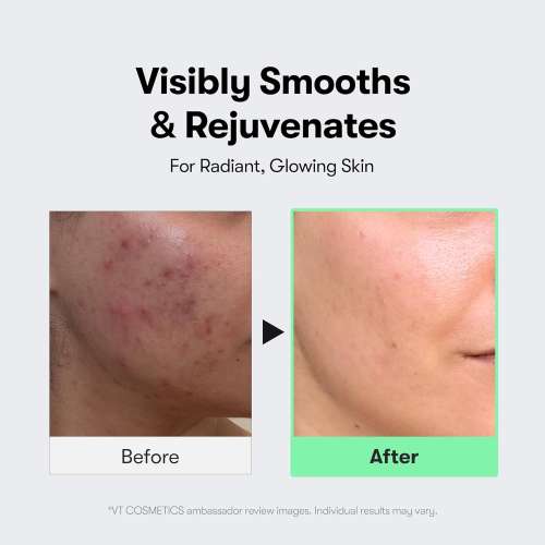 VT Cosmetics: Mild Reedle Shot 50 | Gentle Micro-Needling | Skin Renewal | Sensitive Skin | Daily Essence | 50ml