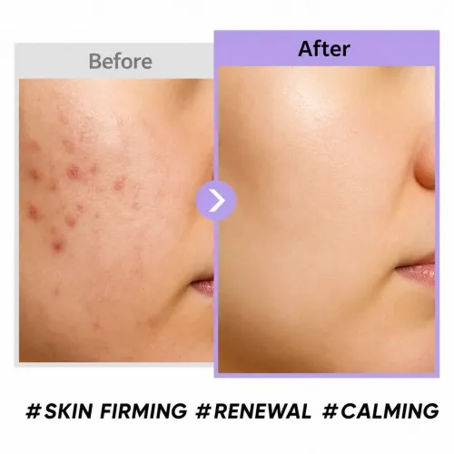 Coxir: Black Snail Collagen Cream | Anti-Aging | Firming & Deep Hydration Face Moisturizer | 50ml