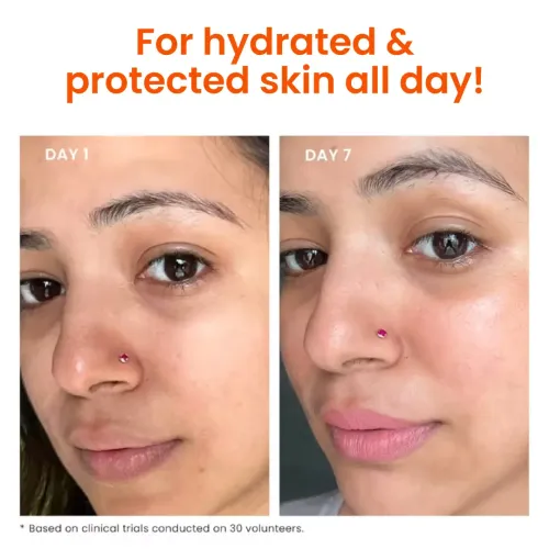 Foxtale: Dewy Sunscreen SPF 50 PA++++ With Niacinamide + Provitamin B5 + Vitamin E   50ml