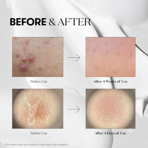 VT Cosmetics: Reedle Shot 700 Essence | Intensive Micro-Needling | Skin Renewal | Anti-Aging | Deep Penetration | 30ml