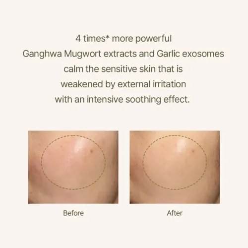 I'm From: Mugwort Serum | Soothing | Calming & Hydrating | 30ml