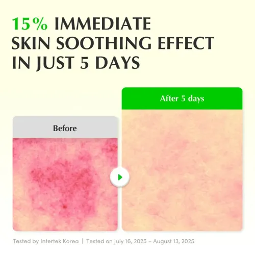Eqqualberry: Aloe PDRN Calming Serum | Soothing Face Serum | Barrier Repair | Hydrating | Sensitive Skin | 30ml