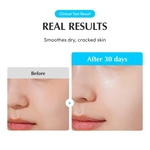Eqqualberry: Swimming Pool Ampoule | Hydrating Face Ampoule | Deep Moisture | Glass Skin | Barrier Repair | 50ml