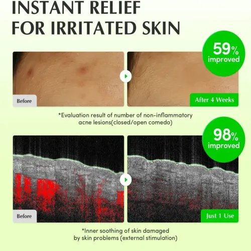 Eqqualberry: Aloe PDRN Calming Toner | Soothing Face Toner | Barrier Repair | Hydrating | Sensitive Skin | 150ml