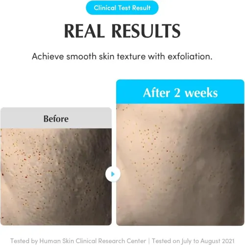 Eqqualberry: Swimming Pool Toner | Hydrating Face Toner | Deep Moisture | Glass Skin | Barrier Repair | 155ml