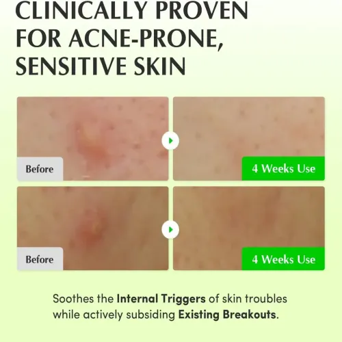 Eqqualberry: Aloe PDRN Calming Toner | Soothing Face Toner | Barrier Repair | Hydrating | Sensitive Skin | 150ml