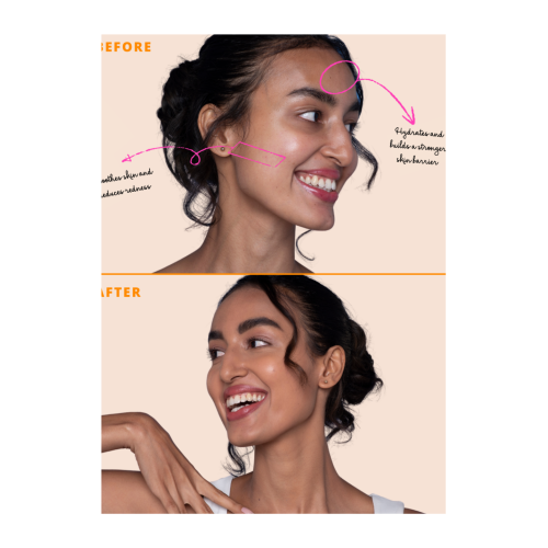 Type Beauty: Calm On Serum Foundation For Sensetive Skin & Redness - Caramel - 3Oml