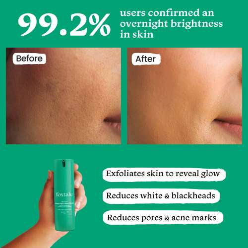 Foxtale: Overnight Glow Mask With 4% Glycolic Acid & 3% Lactic Acid    30ml