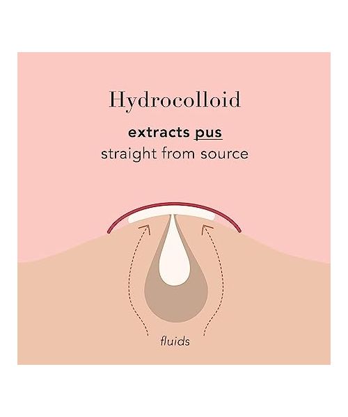 Spot Patch: AM BHA Slims 51 Acne Pimple Patches - 51 Pcs