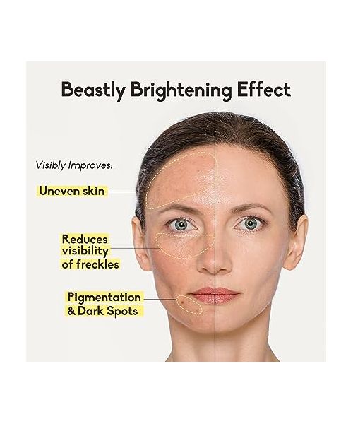 VariHope: 8 Days Brightening Mask With Pure Vitamin C - 5 Sheets