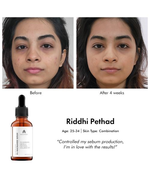 Suganda: 5% Niacinamide Serum - 30ml