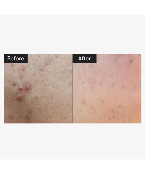 VT Cosmetics: Cica Reedle Shot 300 Essence | 50ml