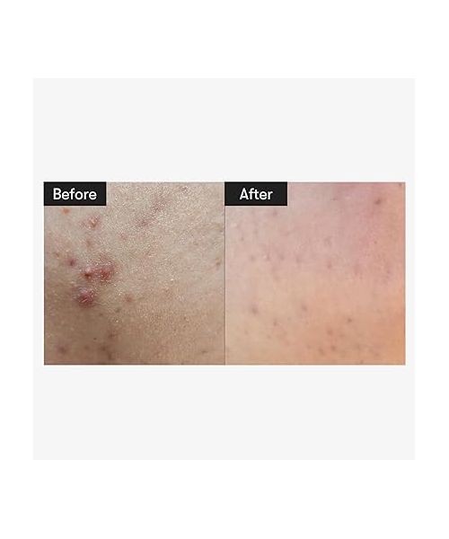 VT Cosmetics: Micro-Needle Cica | Skin Renewal & Smoothing | Essence | 50ml